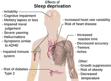 Sleep deprivation chart showing outline of body and parts in ailment